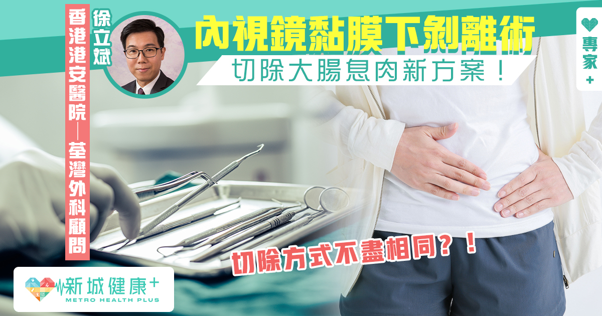 切除大腸瘜肉新方案 認識內視鏡黏膜下剝離術 香港港安醫院 荃灣徐立斌醫生 新城健康