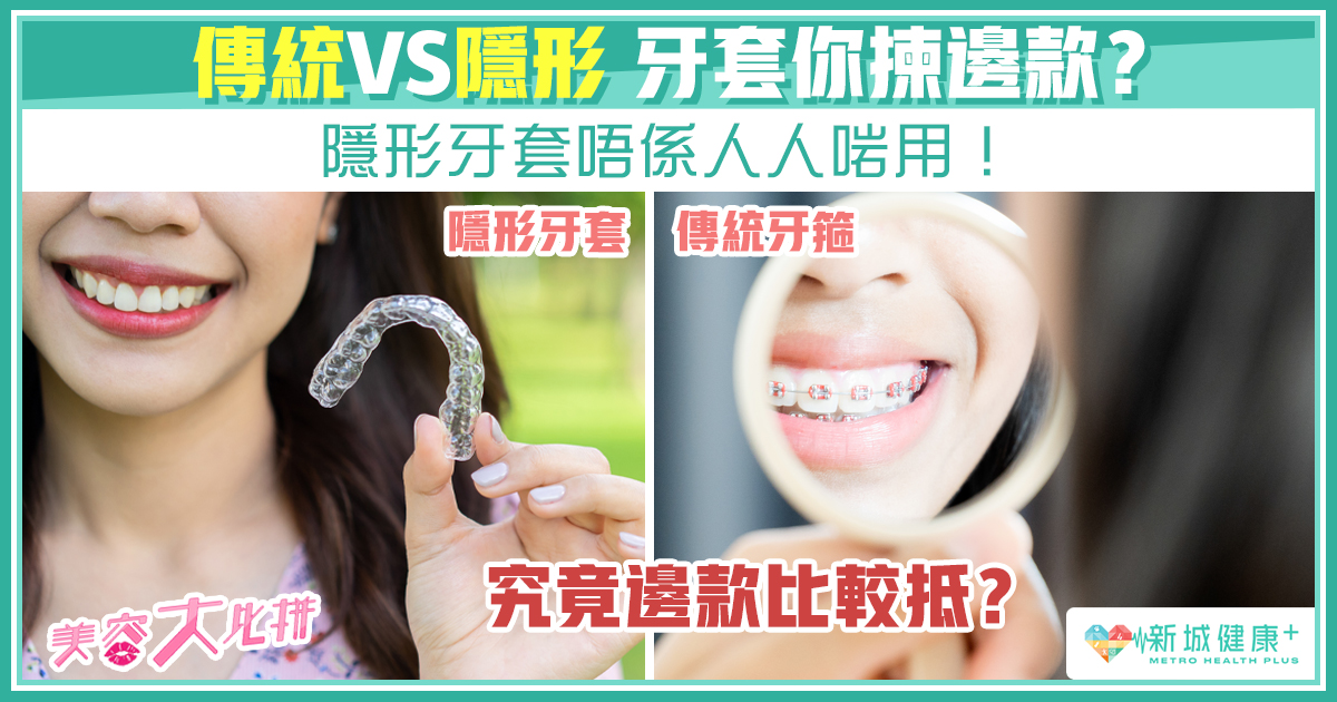 新城健康+ 隱形牙套 箍牙
