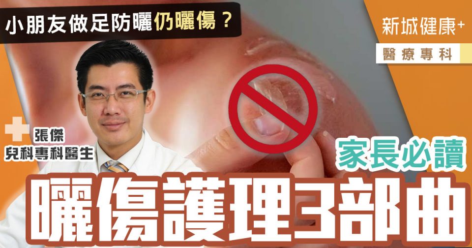 治未病-醫療專科-兒科-兒童防曬-曬傷護理