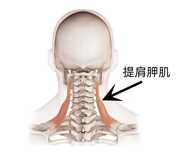運動科學-痛症-物理治療-頸痛-提肩胛肌