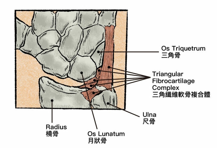 醫療專科-扭傷-手腕-軟骨-三角纖維軟骨複合體
