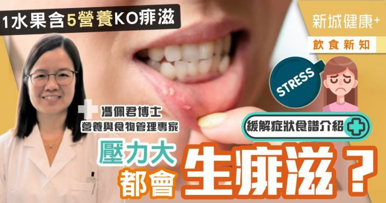 治未病-自然療法-飲食新知-痱滋-奇異果